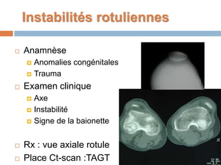 Instabilités rotuliennes 
 Anamnèse 
 Anomalies congénitales 
 Trauma 
 Examen clinique 
 Axe 
 Instabilité 
 Signe de la baionette 
 Rx : vue axiale rotule 
 Place Ct-scan :TAGT 
 