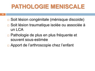 PATHOLOGIE MENISCALE 
36 
 Soit lésion congénitale (ménisque discoide) 
 Soit lésion traumatique isolée ou associée à 
un LCA 
 Pathologie de plus en plus fréquente et 
souvent sous-estimée 
 Apport de l’arthroscopie chez l’enfant 
 