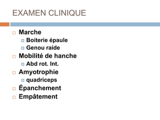 EXAMEN CLINIQUE 
 Marche 
 Boiterie épaule 
 Genou raide 
 Mobilité de hanche 
 Abd rot. Int. 
 Amyotrophie 
 quadriceps 
 Épanchement 
 Empâtement 
 