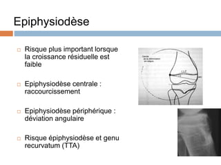 Epiphysiodèse 
 Risque plus important lorsque 
la croissance résiduelle est 
faible 
 Epiphysiodèse centrale : 
raccourcissement 
 Epiphysiodèse périphérique : 
déviation angulaire 
 Risque épiphysiodèse et genu 
recurvatum (TTA) 
 