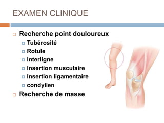 EXAMEN CLINIQUE 
 Recherche point douloureux 
 Tubérosité 
 Rotule 
 Interligne 
 Insertion musculaire 
 Insertion ligamentaire 
 condylien 
 Recherche de masse 
 