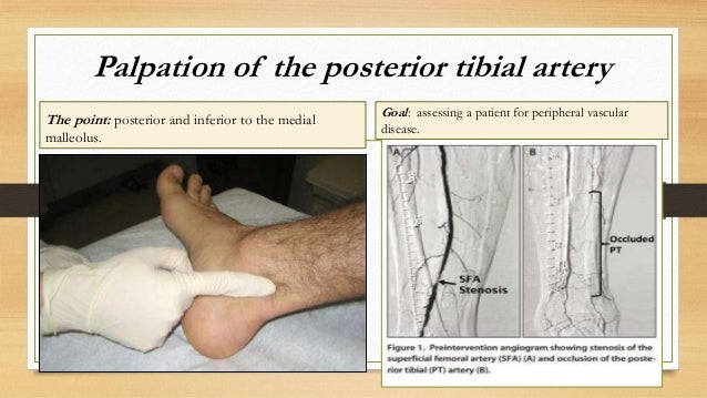 Leg: from anatomy to orthopedisc