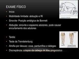 EXAME FÍSICO
• Início
• Mobilidade limitada: abdução e RI
• Sinovite- Posição antálgica de Bonnett
• Abdução: sinovite e espasmo adutores, pode causar
encurtamento dos adutores
• Tardio
• Teste de Trendelenburg
• Atrofia por desuso: coxa, panturrilha e nádegas
• Discrepância: colapso da cabeça  Mau prognóstico
 