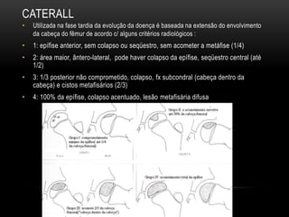 CATERALL
• Utilizada na fase tardia da evolução da doença é baseada na extensão do envolvimento
da cabeça do fêmur de acordo c/ alguns critérios radiológicos :
• 1: epífise anterior, sem colapso ou seqüestro, sem acometer a metáfise (1/4)
• 2: área maior, ântero-lateral, pode haver colapso da epífise, seqüestro central (até
1/2)
• 3: 1/3 posterior não comprometido, colapso, fx subcondral (cabeça dentro da
cabeça) e cistos metafisários (2/3)
• 4: 100% da epífise, colapso acentuado, lesão metafisária difusa
 