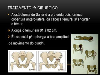 TRATAMENTO  CIRÚRGICO
• A osteotomia de Salter é a preferida pois fornece
cobertura antero-lateral da cabeça femural s/ encurtar
o fêmur.
 Alonga o fêmur em 01 á 02 cm.
 É essencial p/ a cirurgia a boa amplitude
de movimento do quadril.
 