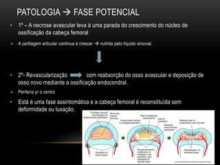 PATOLOGIA  FASE POTENCIAL
• 1º – A necrose avascular leva á uma parada do crescimento do núcleo de
ossificação da cabeça femoral
 A cartilagem articular continua á crescer  nutrida pelo líquido sinovial.
• 2º- Revascularização com reabsorção do osso avascular e deposição de
osso novo mediante a ossificação endocondral.
 Periferia p/ o centro
• Está é uma fase assintomática e a cabeça femoral é reconstituída sem
deformidade ou luxação.
 