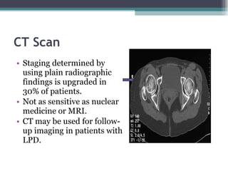 CT Scan Staging determined by using plain radiographic findings is upgraded in 30% of patients. Not as sensitive as nuclear medicine or MRI. CT may be used for follow-up imaging in patients with LPD.  