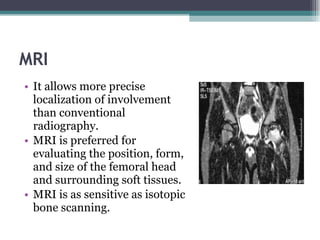 MRI It allows more precise localization of involvement than conventional radiography. MRI is preferred for evaluating the position, form, and size of the femoral head and surrounding soft tissues.  MRI is as sensitive as isotopic bone scanning. 
