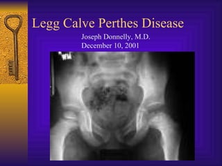 Legg Calve Perthes Disease
        Joseph Donnelly, M.D.
        December 10, 2001
 