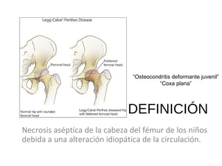 DEFINICIÓN
Necrosis aséptica de la cabeza del fémur de los niños
debida a una alteración idiopática de la circulación.
“Osteocondritis deformante juvenil”
“Coxa plana”
 