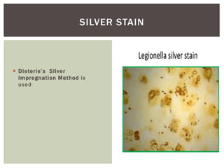 SILVER STAIN
 Dieterle’s Silver
Impregnation Method is
used
 