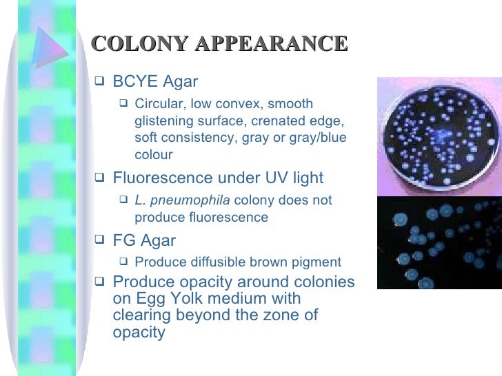 Legionella+Mycoplasma+Atypical Pneumonia