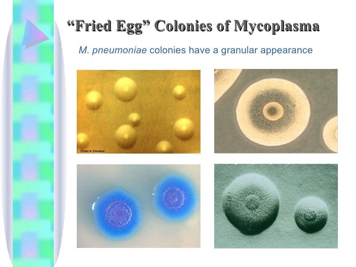 Legionella+Mycoplasma+Atypical Pneumonia