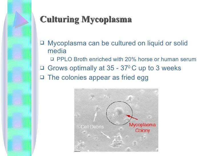 Legionella+Mycoplasma+Atypical Pneumonia