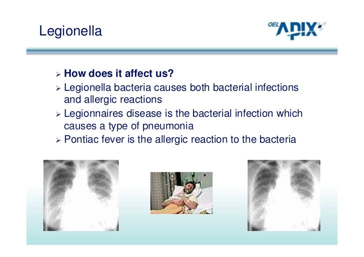 Legionella Presentation NESHEP (Oct 2012)