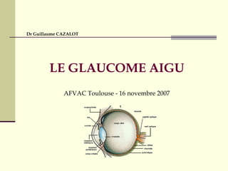 LE GLAUCOME AIGU
AFVAC Toulouse - 16 novembre 2007
Dr Guillaume CAZALOT
 