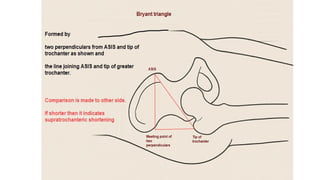 Leg Length Measurement true and apparent measurement limb length ...