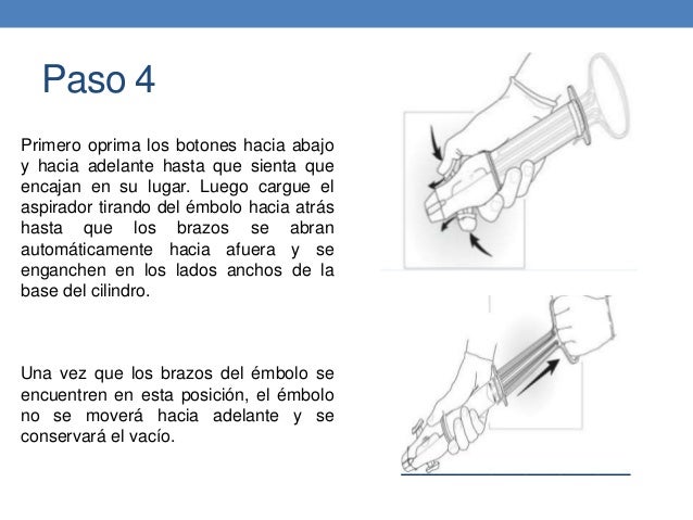Que es legrado uterino pdf