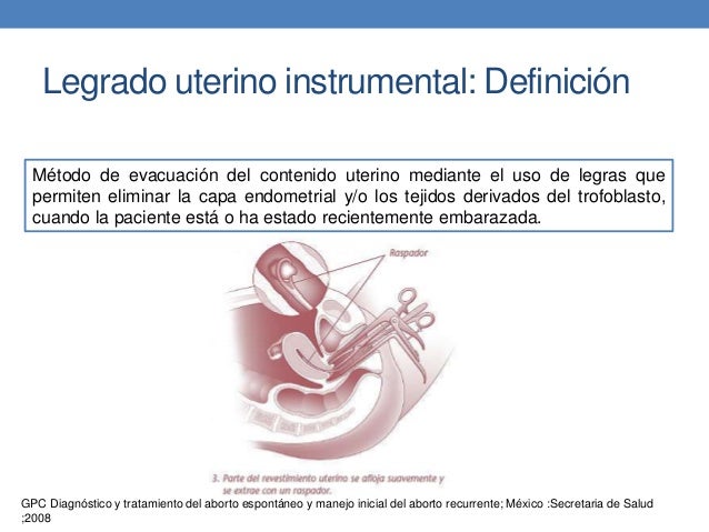 Que es legrado uterino pdf