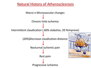 Natural History of Atherosclesrosis 
Macro n Microvascular changes 
Chronic limb ischemia 
Intermittent claudication ( 60% stabalise, 20 %improve) 
(20%)Decrease claudication distance 
Nocturnal ischemic pain 
Rest pain 
Progressive ischemia 
 