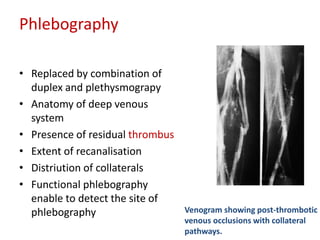 Phlebography 
• Replaced by combination of 
duplex and plethysmograpy 
• Anatomy of deep venous 
system 
• Presence of residual thrombus 
• Extent of recanalisation 
• Distriution of collaterals 
• Functional phlebography 
enable to detect the site of 
phlebography Venogram showing post-thrombotic 
venous occlusions with collateral 
pathways. 
 