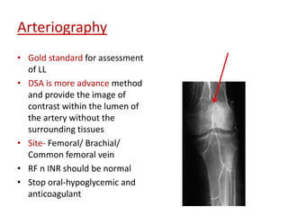 Arteriography 
• Gold standard for assessment 
of LL 
• DSA is more advance method 
and provide the image of 
contrast within the lumen of 
the artery without the 
surrounding tissues 
• Site- Femoral/ Brachial/ 
Common femoral vein 
• RF n INR should be normal 
• Stop oral-hypoglycemic and 
anticoagulant 
 