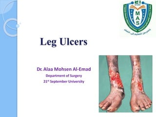 Leg Ulcers
Dr. Alaa Mohsen Al-Emad
Department of Surgery
21st September University
 