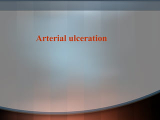 Arterial ulceration
 