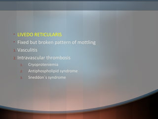 • LIVEDO RETICULARIS
• Fixed but broken pattern of mottling
1. Vasculitis
2. Intravascular thrombosis
1. Cryoproteniemia
2. Antiphospholipid syndrome
3. Sneddon`s syndrome
 