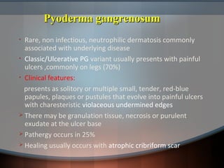 Pyoderma gangrenosumPyoderma gangrenosum
• Rare, non infectious, neutrophilic dermatosis commonly
associated with underlying disease
• Classic/Ulcerative PG variant usually presents with painful
ulcers ,commonly on legs (70%)
• Clinical features:
presents as solitory or multiple small, tender, red-blue
papules, plaques or pustules that evolve into painful ulcers
with charesteristic violaceous undermined edges
 There may be granulation tissue, necrosis or purulent
exudate at the ulcer base
 Pathergy occurs in 25%
 Healing usually occurs with atrophic cribriform scar
 