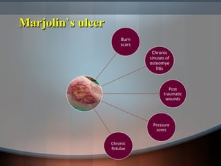 Marjolin`s ulcerMarjolin`s ulcer
 