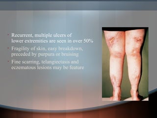 • Recurrent, multiple ulcers of
lower extremities are seen in over 50%
• Fragility of skin, easy breakdown, usually
preceded by purpura or bruising
• Fine scarring, telangiectasis and
eczematous lesions may be feature
 