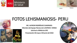 FOTOS LEHISMANIOSIS- PERU
MC. ALFREDO RODRÍGUEZ CUADRADO.
Miembro del Equipo Técnico de la DCPEM-Z- MINSA
Solicitud a MINSA de OPS
Presentación 30 mayo al 30 junio del 2018
 