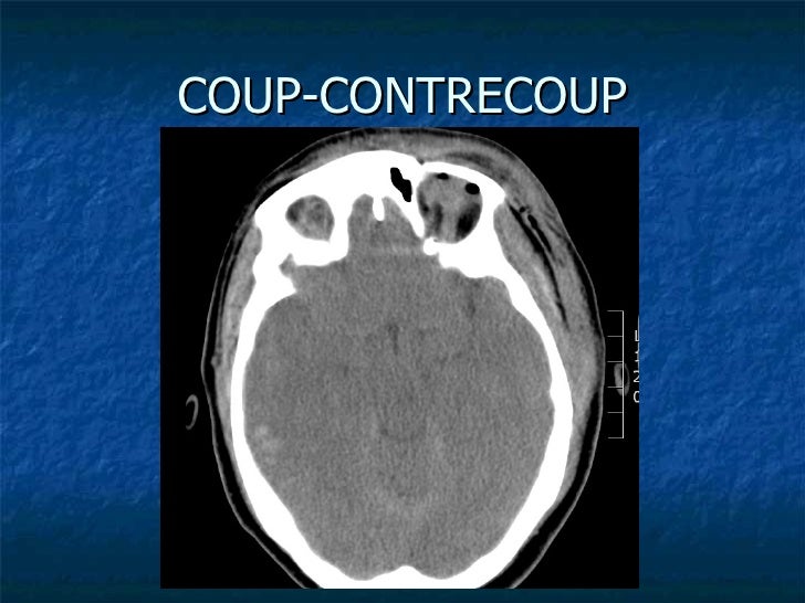 for exam concussion Leininger concussion physiatric approach to