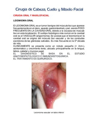 CIRUGIA ORAL Y MAXILOFACIAL
LEIOMIOMA ORAL
El LEIOMIOMA ORAL esun tumor benigno del músculo liso que aparece
frecuentemente en el útero, aparato gastrointestinal y piel, siendo POCO
FRECUENTE EN LA CAVIDAD ORAL debido a la escasez de músculo
liso en esta localización. El subtipo histológico más común en la cavidad
oral es el VASCULAR (angiomioma). Se postula que el leiomioma en la
cavidad oral se origina del músculo liso vascular y de los conductos
excretores de las glándulas salivales. Es más frecuente en la 5ª década
de vida.
CLINICAMENTE se presenta como un nódulo pequeño (< 2cm.),
asintomático y crecimiento lento, ubicado principalmente en la lengua,
labios, paladar y mucosa yugal.
EL DIAGNOSTICO SE BASA EN EL ESTUDIO
ANATOMOPATOLOGICO E INMUNOHISTOQUIMICA.
EL TRATAMIENTO ES QUIRURGICO.
Leiomioma vascular en labio inferior