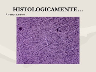 HISTOLOGICAMENTE…HISTOLOGICAMENTE…
A menor aumento…
 