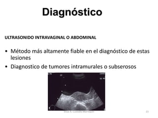 ULTRASONIDO INTRAVAGINAL O ABDOMINAL
• Método más altamente fiable en el diagnóstico de estas
lesiones
• Diagnostico de tumores intramurales o subserosos
Diagnóstico
23Jesús A. Custodio Marroquín
 