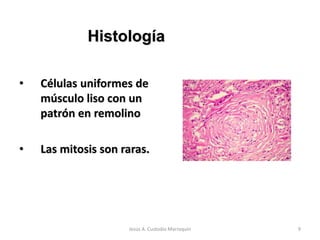 • Células uniformes de
músculo liso con un
patrón en remolino
• Las mitosis son raras.
Jesús A. Custodio Marroquín 9
Histología
 