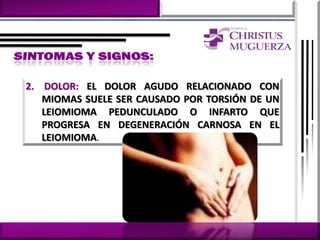 2. DOLOR: EL DOLOR AGUDO RELACIONADO CON
   MIOMAS SUELE SER CAUSADO POR TORSIÓN DE UN
   LEIOMIOMA PEDUNCULADO O INFARTO QUE
   PROGRESA EN DEGENERACIÓN CARNOSA EN EL
   LEIOMIOMA.
 