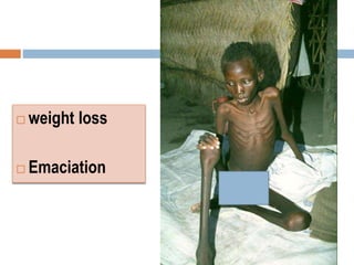  weight loss
 Emaciation
 