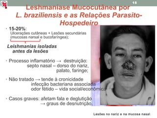 Leshmaníase Mucocutânea por  L. braziliensis e as Relações Parasito-Hospedeiro 15-20% :  Ulcerações cutâneas + Lesões secundárias  (mucosas narsal e bucofaríngea); Leishmanias isoladas  antes da lesões Processo inflamatório ->  destruição:  septo nasal – dorso do nariz,  palato, faringe; Não tratado -> tende à cronicidade  infecção bacteriana associada odor fétido – vida social/econômica Casos graves: afetam fala e deglutição  ->  graus de desnutrição. Lesões no nariz e na mucosa nasal . 