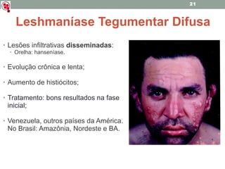 Lesões infiltrativas  disseminadas : Orelha: hanseníase. Evolução crônica e lenta; Aumento de histiócitos; Tratamento: bons resultados na fase inicial; Venezuela, outros países da América. No Brasil: Amazônia, Nordeste e BA. Leshmaníase Tegumentar Difusa 