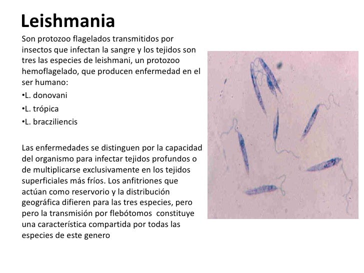 Leishmania block diagram in powerpoint 