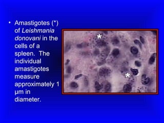 • Amastigotes (*)
of Leishmania
donovani in the
cells of a
spleen. The
individual
amastigotes
measure
approximately 1
µm in
diameter.

 