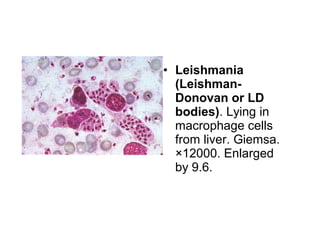 • Leishmania
(Leishman-
Donovan or LD
bodies). Lying in
macrophage cells
from liver. Giemsa.
×12000. Enlarged
by 9.6.
 