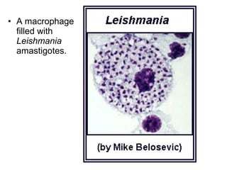 • A macrophage
filled with
Leishmania
amastigotes.
 