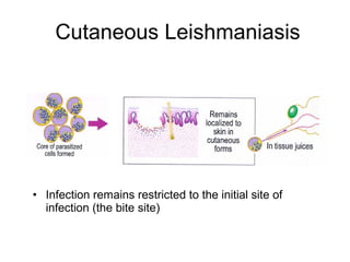 Cutaneous Leishmaniasis
• Infection remains restricted to the initial site of
infection (the bite site)
 