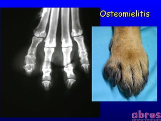 OsteomielitisOsteomielitis
 