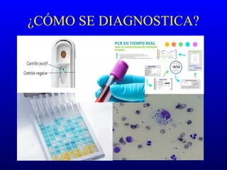 ¿CÓMO SE DIAGNOSTICA?
 