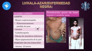 CUADRO CLÍNICO:
LESIÓN:
- Hepato esplenomegalia
- Fiebreintermitente
- pérdida de peso
- Anemia
- Linfadenopatía
- Edema de miembros inferiores
- Hiper-pigmentación de la piel
PERIODO DE INCUBACIÓN:
- 4meses- 10 meses
Parasitación grave de bazo,
hígado ó médula ósea.
 